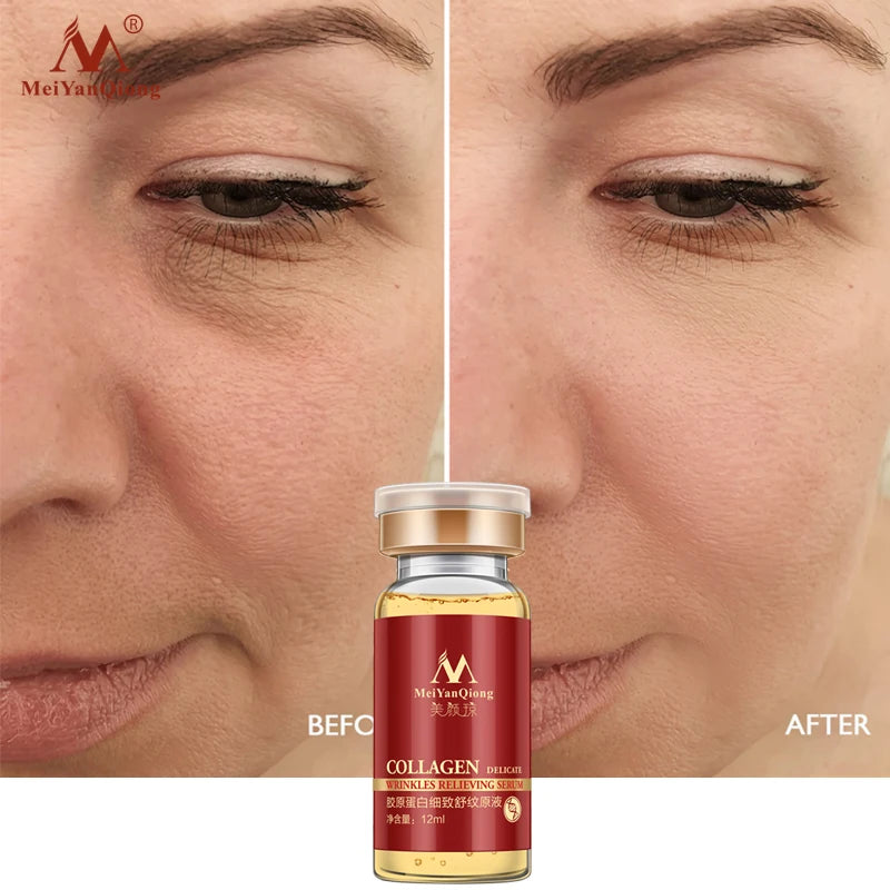 Anti-Aging Serum for Lifting & Wrinkle Reduction